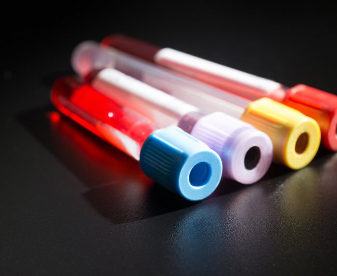 6 raisons cachees qui peuvent augmenter votre taux de creatinine 