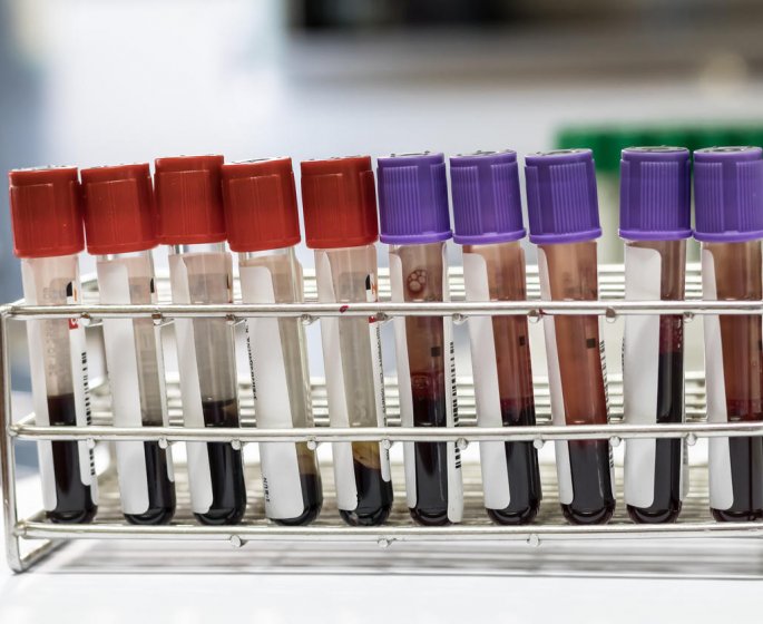 Creatinine ou creatine : la difference
