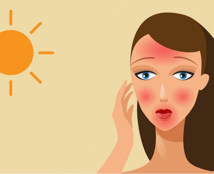 Coup de soleil au visage : 5 trucs a ne surtout pas mettre dessus