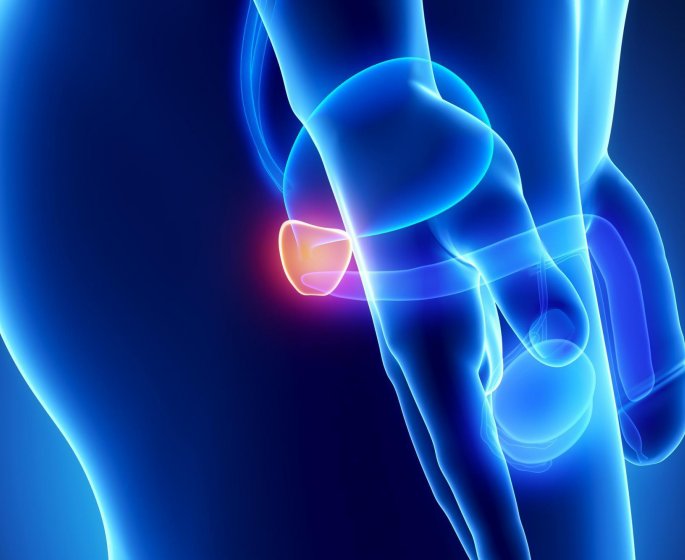 Ablation de la prostate : comment ca se passe ? 