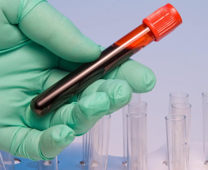 ASAT et ALAT : les deux types de transaminases