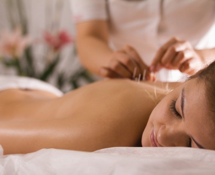Diabete de type 2 : l’acupuncture permettrait d’eviter la maladie