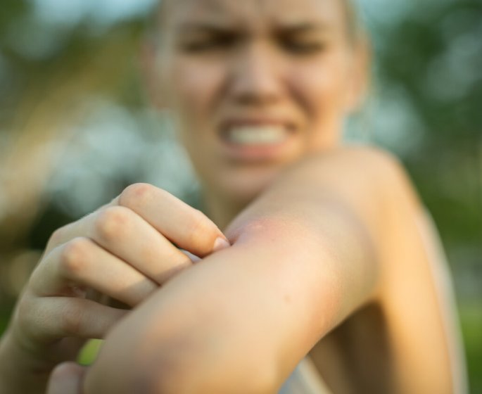 Tiques : comment reagir a une piqure ?