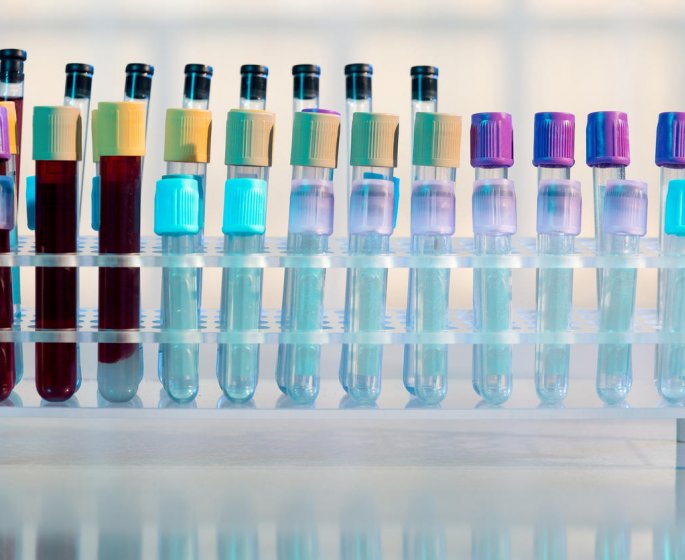 Transaminases SGPT ou SGOT : la difference