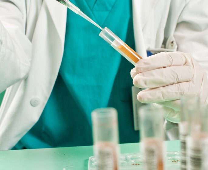 Cancer de la prostate : il existerait deux sous-types de la maladie