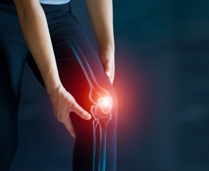 Arthrose du genou : 3 recettes de cataplasme pour soulager les douleurs