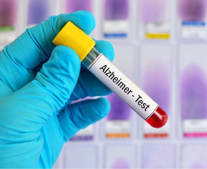 Alzheimer : ce test peut detecter la maladie 17 ans plus tot