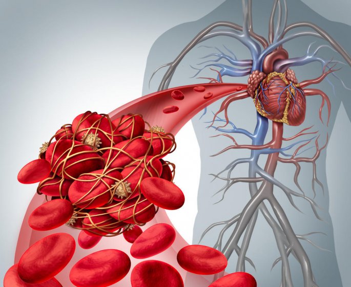 Tachycardie (ventriculaire-supraventriculaire) : definition, causes, traitements