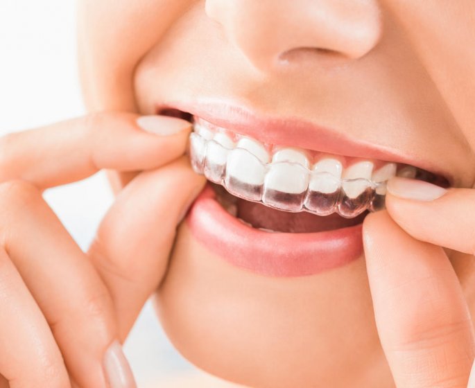 Ces kits pour blanchir les dents favorisent leur erosion