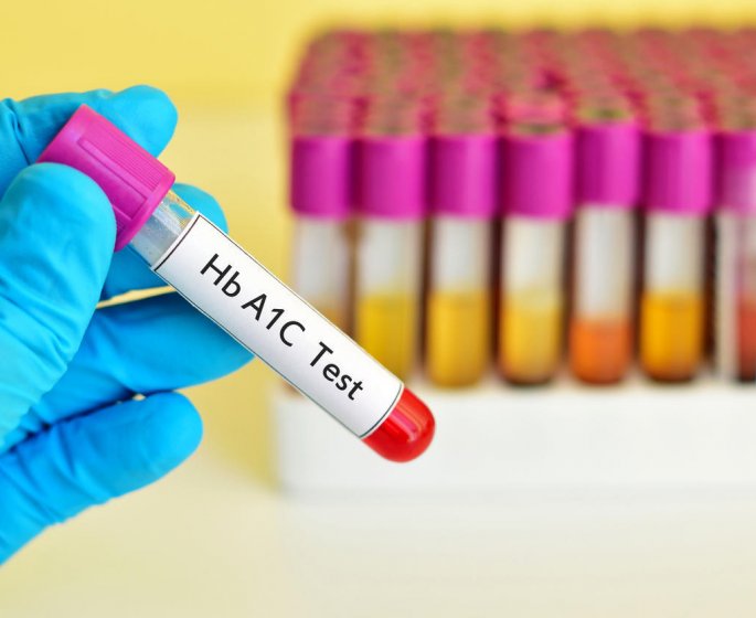 HbA1c : comment faire baisser l-hemoglobine glyquee ?