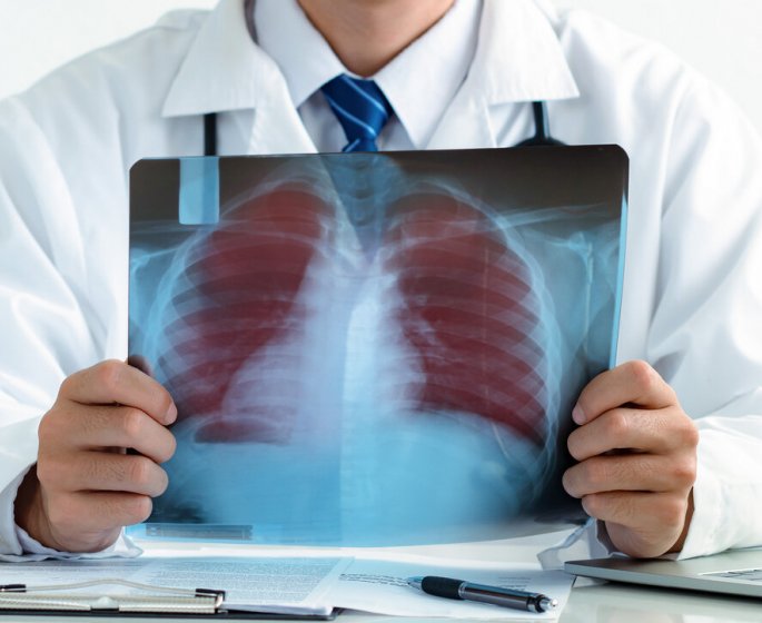 Ce signe sur votre bras peut etre un symptome du cancer du poumon 