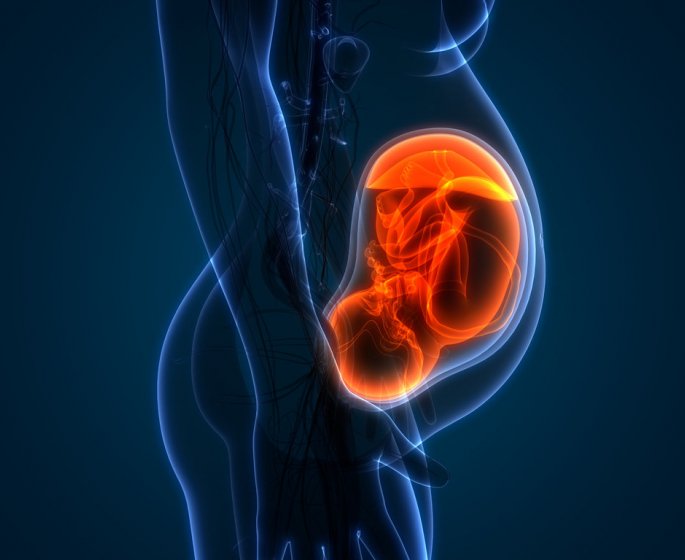 Syndrome de Sturge-Weber (ou SSW) : c-est quoi ?