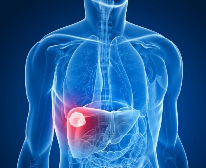 Quels sont les cancers les plus dangereux ?