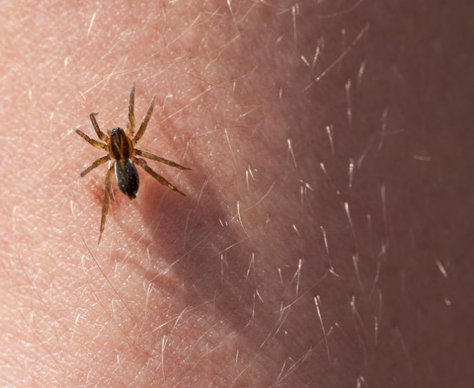 Reconnaitre une morsure d-araignee