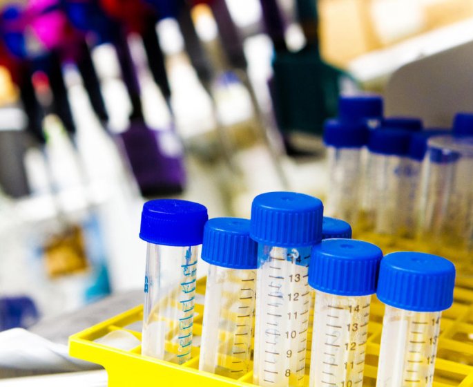 Tuberculose urinaire : quand faire un ECBU ?
