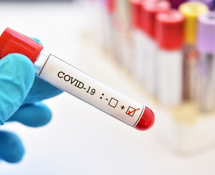 COVID-19 : les 10 departements ou les admissions a l-hopital ont grimpe cette semaine