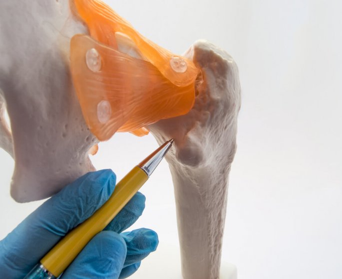 Fracture du femur : le traitement par clou gamma