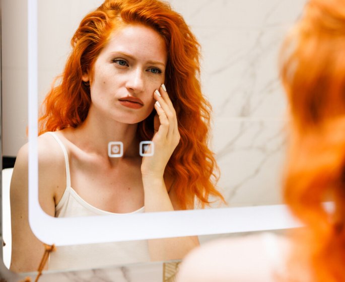 Acne, poches sous les yeux : 5 types d- aliments qui fatiguent la peau