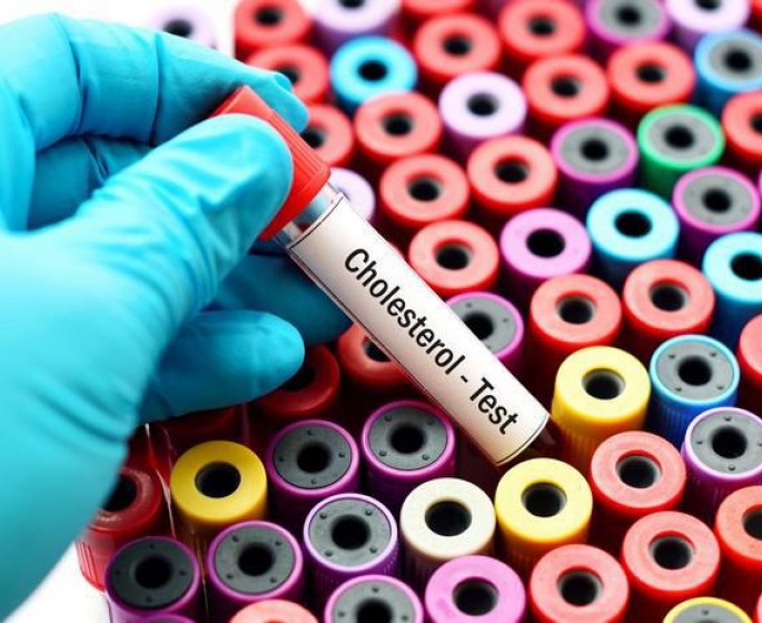 Hypercholesterolemie : les taux a ne pas depasser