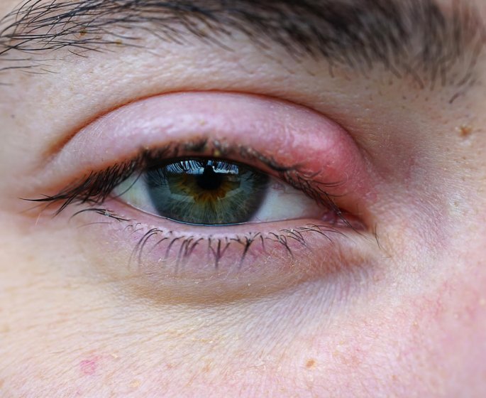 Orgelet : comment eviter la contagion ?