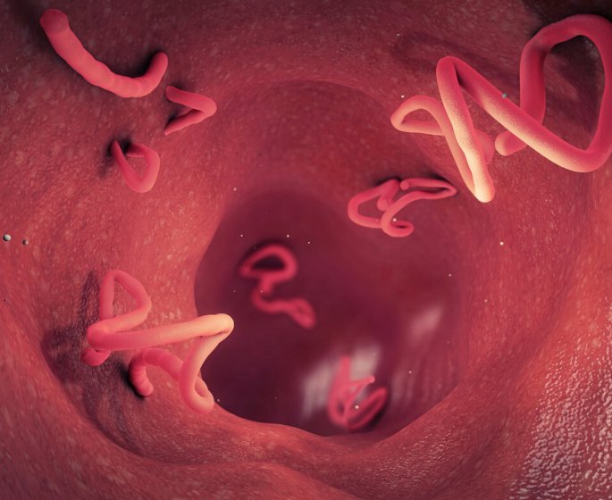 Maux de tete : des vers peuvent circuler dans le cerveau