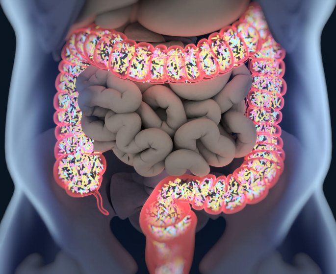 Cancer du colon : un nouveau test pour detecter la forme la plus frequente