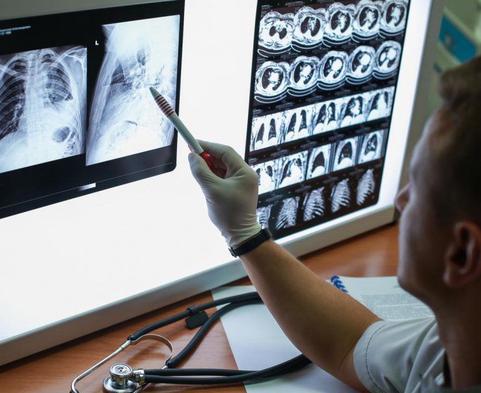 Pneumonie : les bacteries en cause dans cette infection