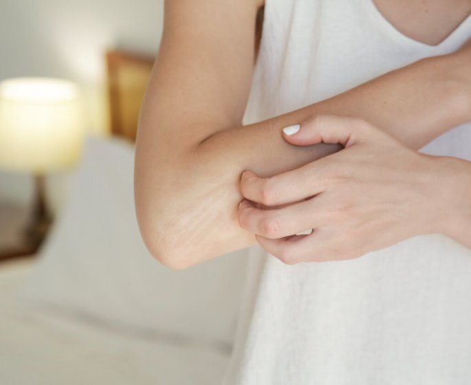 Comment reconnaitre les symptomes d’un zona sur le bras ?