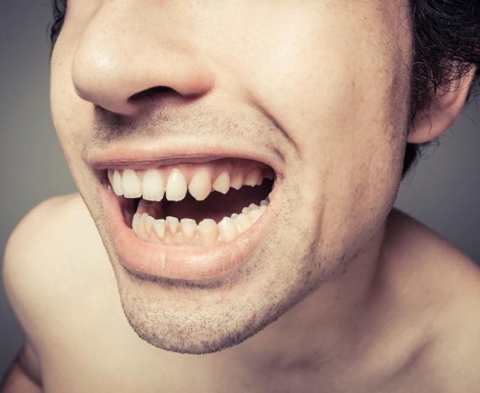 Comment enlever le tartre sur les dents
