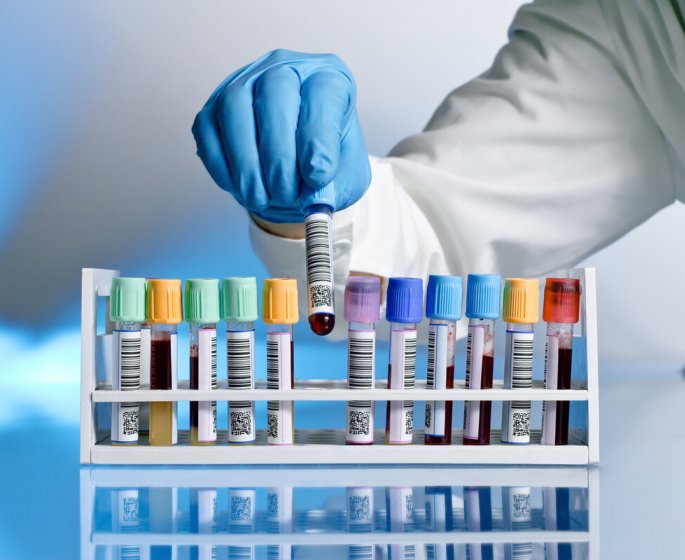 Un nouveau test capable de detecter 18 cancers de facon precoce a l’essai