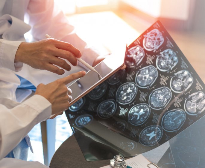 Sclerose en plaques (SEP) : une etude revele qu’une grande majorite de malades consultent des annees avant le diagnostic pour ces deux problemes