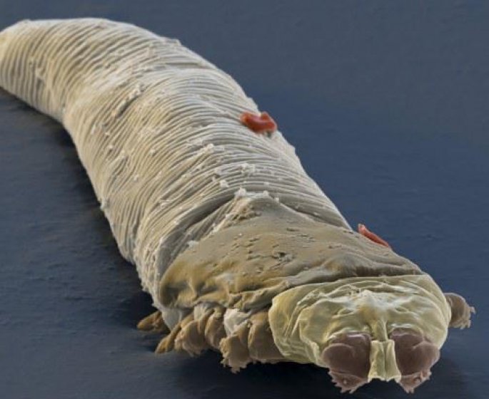 70% des plus de 50 ans ont cette petite bete sur la peau