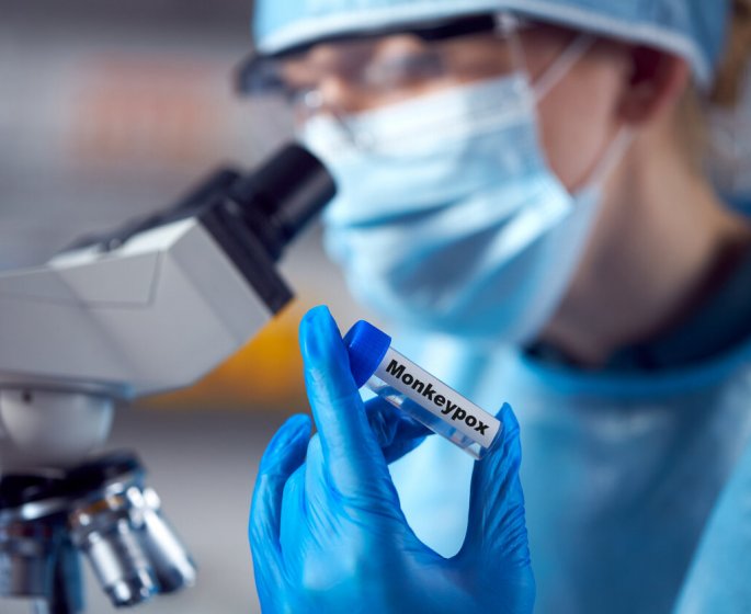 Une nouvelle forme de la variole du singe detectee