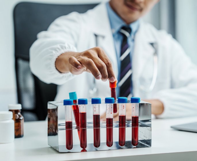 Un simple test sanguin pourrait etre efficace pour detecter ce type de cancer