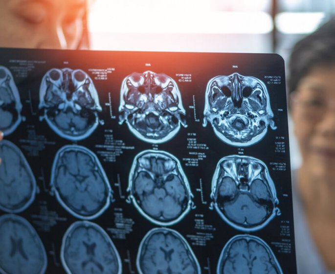 Ces medicaments pour le cœur protegent de la demence selon une etude suedoise 
