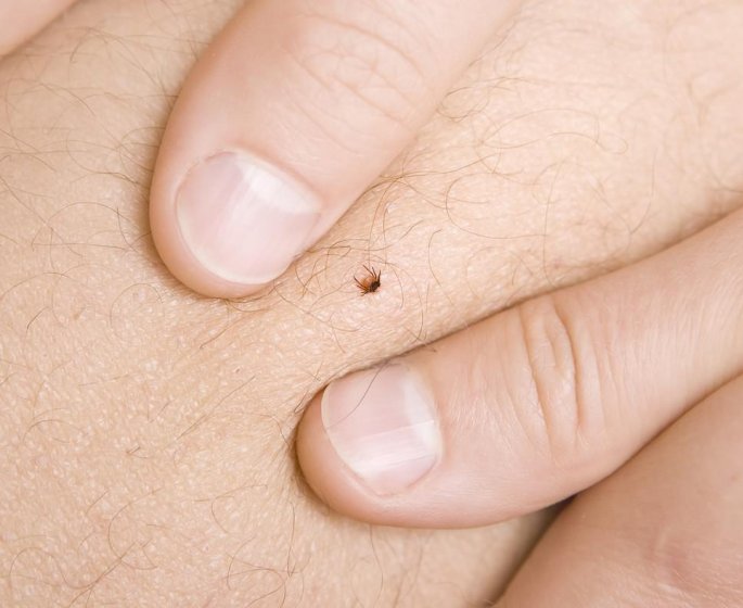 Maladie de Lyme : reconnaitre la lesion typique de l’infection 