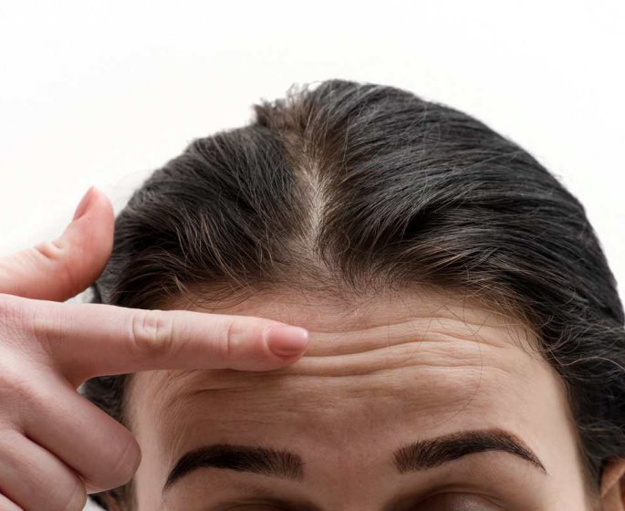 Medecine esthetique : le plasmage pour ameliorer sa peau