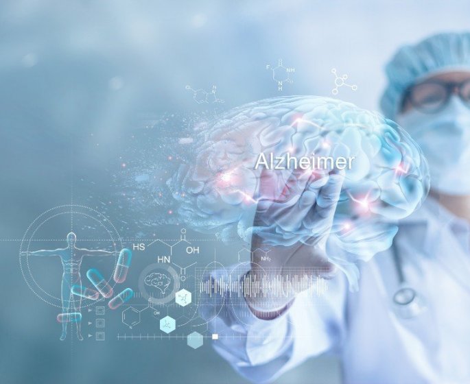 Alzheimer : les taux de cholesterol et glucose a 35 ans associes a la maladie
