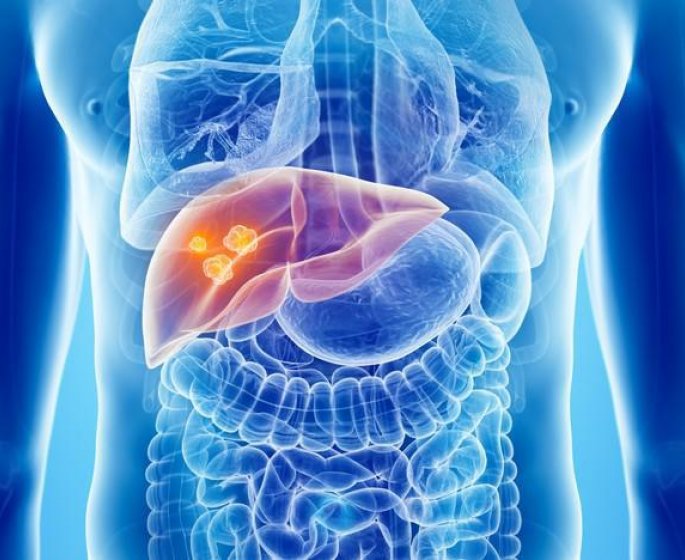 Cancer du foie : des aliments a eviter ?