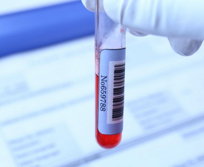 Taux d’immunoglobuline : l’anomalie du sang qui peut evoluer en cancer
