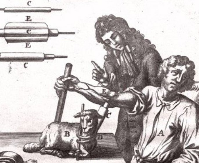 Transfusion sanguine chez l-homme : la folle histoire de sa mise au point