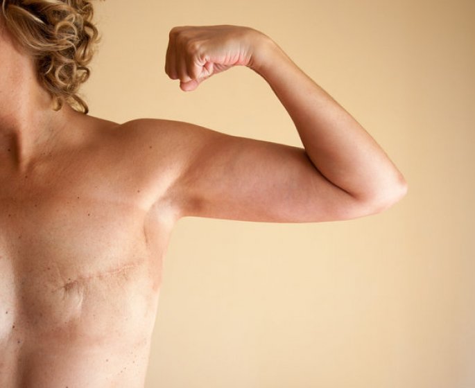 Cancer du sein : elle subit une ablation mammaire apres une erreur de diagnostic