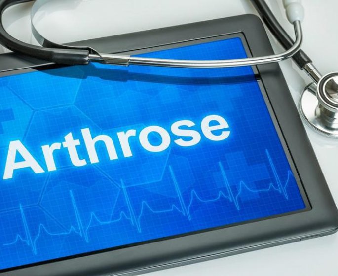 Arthrose : 6 actions a mener pour mieux vivre avec la maladie