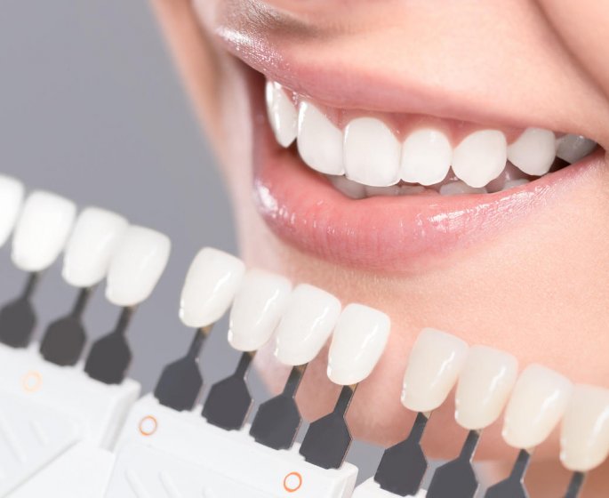 Blanchiment des dents : le danger des &quot;bars a sourire&quot;