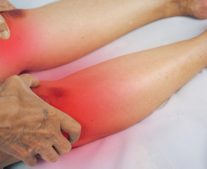 Rhumatisme psoriasique, un rhumatisme inflammatoire chronique