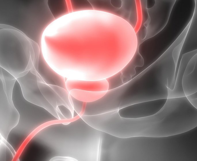 Les aliments qui augmentent le risque d’un cancer de la prostate avance