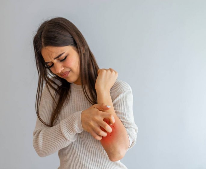 Eczema, une maladie de peau qui impacte aussi la vie de couple