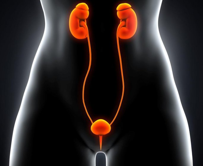 Pyelonephrite aigue (infection grave du rein) : definition, symptomes, causes, traitements