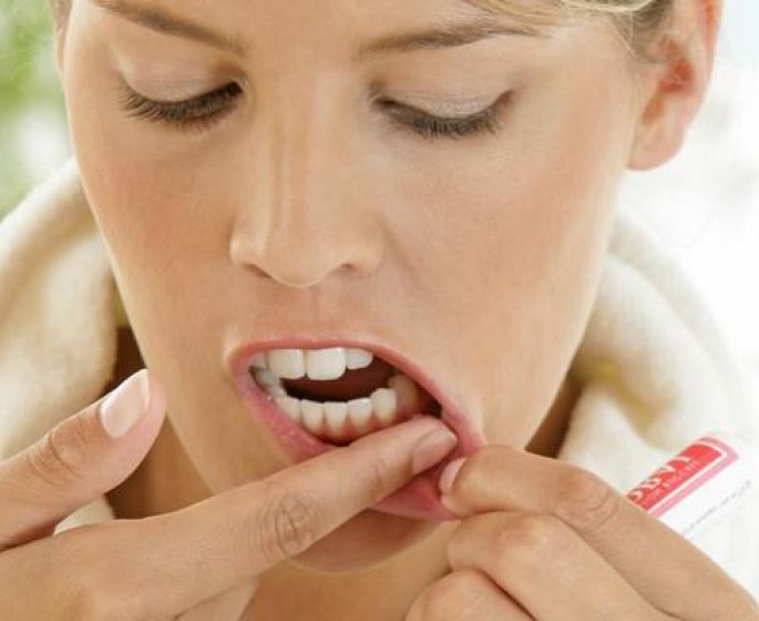 Aphte sur la gencive : tout savoir avec le Dr Anne Christine Della Valle