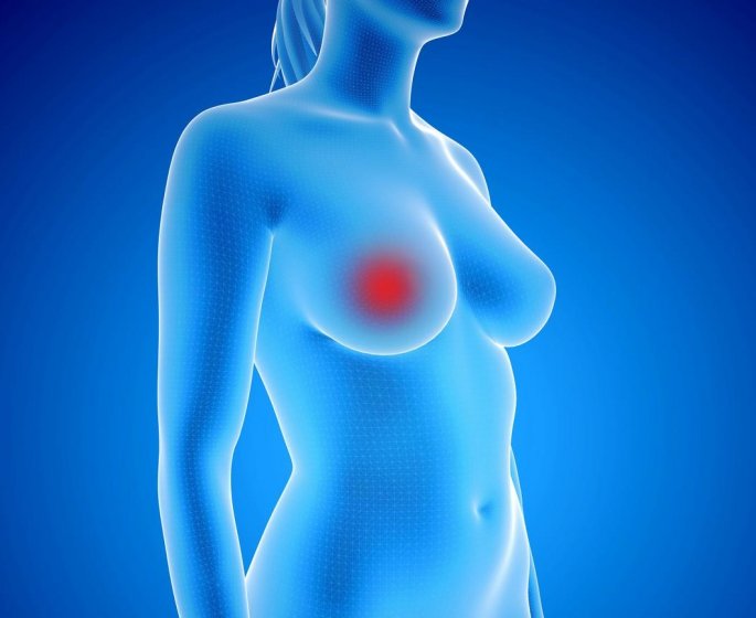 Cancer du sein : quels sont les vrais signes ?